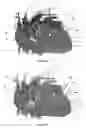 Fig. 30 - Systems for heart treatment