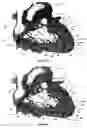Fig. 32 - Systems for heart treatment