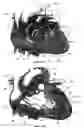 Fig. 35 - Systems for heart treatment