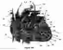 Fig. 40 - Systems for heart treatment
