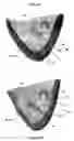 Fig. 47 - Systems for heart treatment