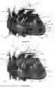 Fig. 52 - Systems for heart treatment