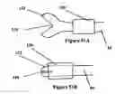 Fig. 55 - Systems for heart treatment