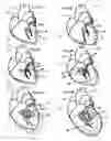Fig. 02 - Systems for heart treatment