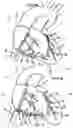 Fig. 04 - Systems for heart treatment