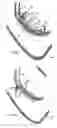 Fig. 06 - Systems for heart treatment