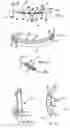 Fig. 09 - Systems for heart treatment