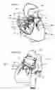 Fig. 13 - Systems for heart treatment
