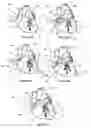 Fig. 14 - Systems for heart treatment