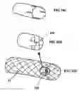 Fig. 23 - Systems for heart treatment