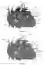 Fig. 28 - Systems for heart treatment