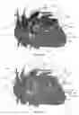 Fig. 30 - Systems for heart treatment