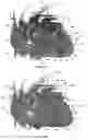 Fig. 31 - Systems for heart treatment