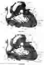 Fig. 32 - Systems for heart treatment