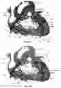 Fig. 33 - Systems for heart treatment