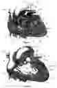 Fig. 35 - Systems for heart treatment