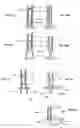 Fig. 45 - Systems for heart treatment