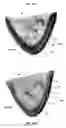 Fig. 47 - Systems for heart treatment