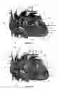 Fig. 52 - Systems for heart treatment