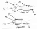 Fig. 55 - Systems for heart treatment