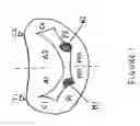 Fig. 02 - Internal prosthesis for reconstruction of cardiac geometry