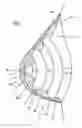 Fig. 02 - Breast prosthesis