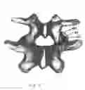 Fig. 08 - Facet joint prosthesis and method of replacing a facet joint