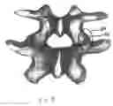 Fig. 09 - Facet joint prosthesis and method of replacing a facet joint