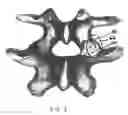 Fig. 10 - Facet joint prosthesis and method of replacing a facet joint