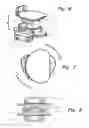 Fig. 04 - Spinal implant