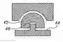 Fig. 01 - Spinal prosthesis