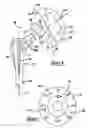Fig. 05 - Shoulder prosthesis