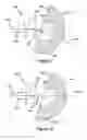Fig. 06 - Shoulder prosthesis