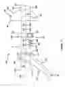 Fig. 07 - Shoulder prosthesis