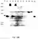 Fig. 27 - Production of recombinant polypeptides by bovine species and transgenic methods