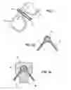 Fig. 02 - Volume-flexible body fillable with a fluid element