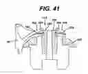 Fig. 32 - Shaving system