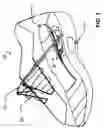 Fig. 02 - Self tying shoe