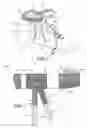 Fig. 02 - Ankle and foot stabilization support