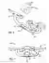 Fig. 04 - Nonpiercing jewelry that presents pierced effect