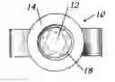 Fig. 01 - Gem setting