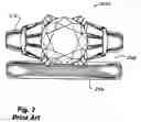 Fig. 03 - Gemstone finger ring