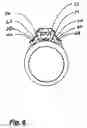 Fig. 07 - Gemstone finger ring
