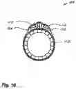 Fig. 11 - Gemstone finger ring