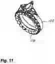 Fig. 12 - Gemstone finger ring