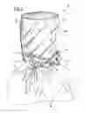 Fig. 02 - Helmet for artificial respiration