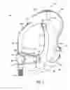 Fig. 02 - Ergonomic and adjustable respiratory mask assembly with headgear assembly