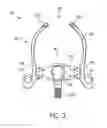 Fig. 05 - Ergonomic and adjustable respiratory mask assembly with headgear assembly