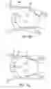 Fig. 17 - Ergonomic and adjustable respiratory mask assembly with headgear assembly