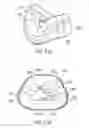 Fig. 35 - Ergonomic and adjustable respiratory mask assembly with headgear assembly